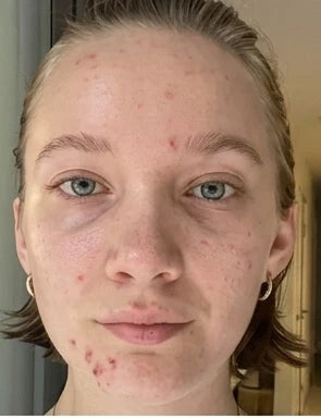 Peau de Sofie avant utilisation