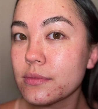 Peau de Maria avant utilisation