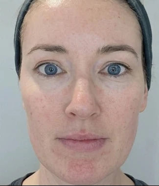 Peau de Jessica avant utilisation